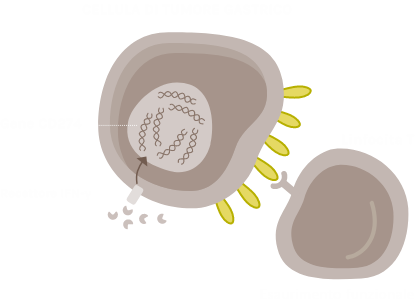 Tumore Gastrico